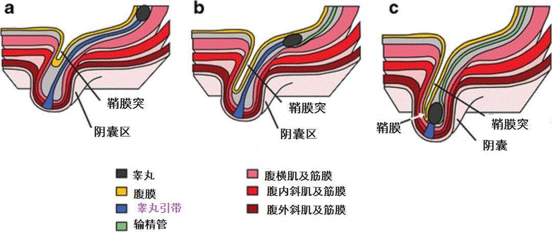 胚胎睾丸下降过程动画图片