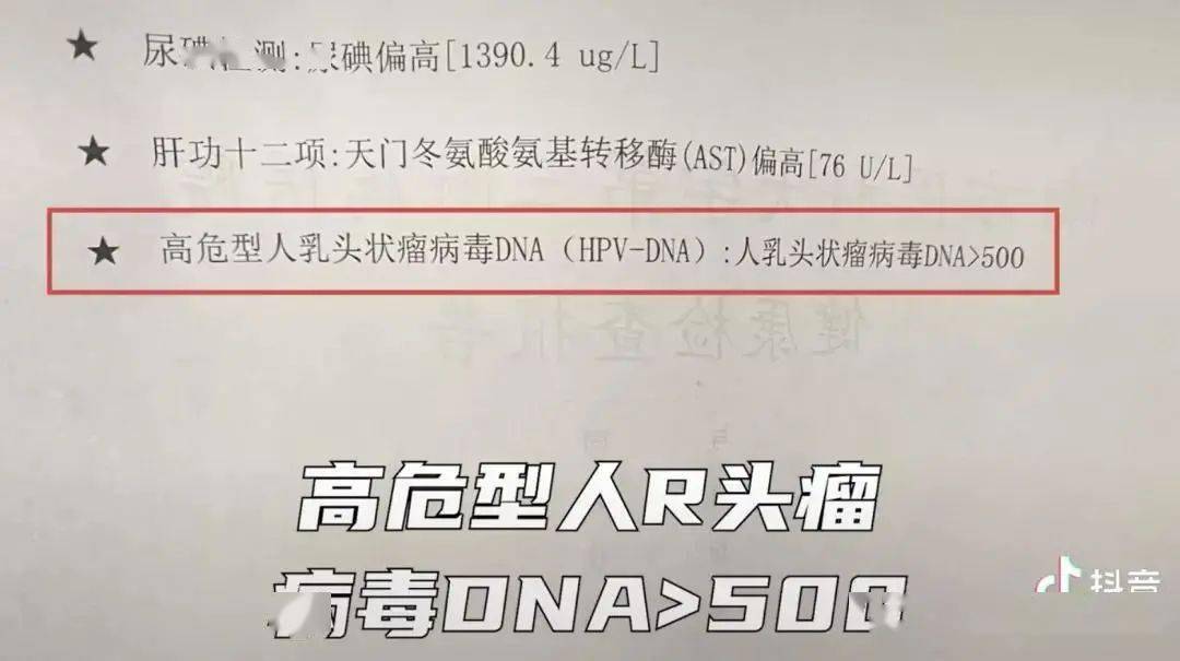 此轮疫情溯源修法严惩拐卖妇女衡水警方通报立即暂停食用该奶粉hpv