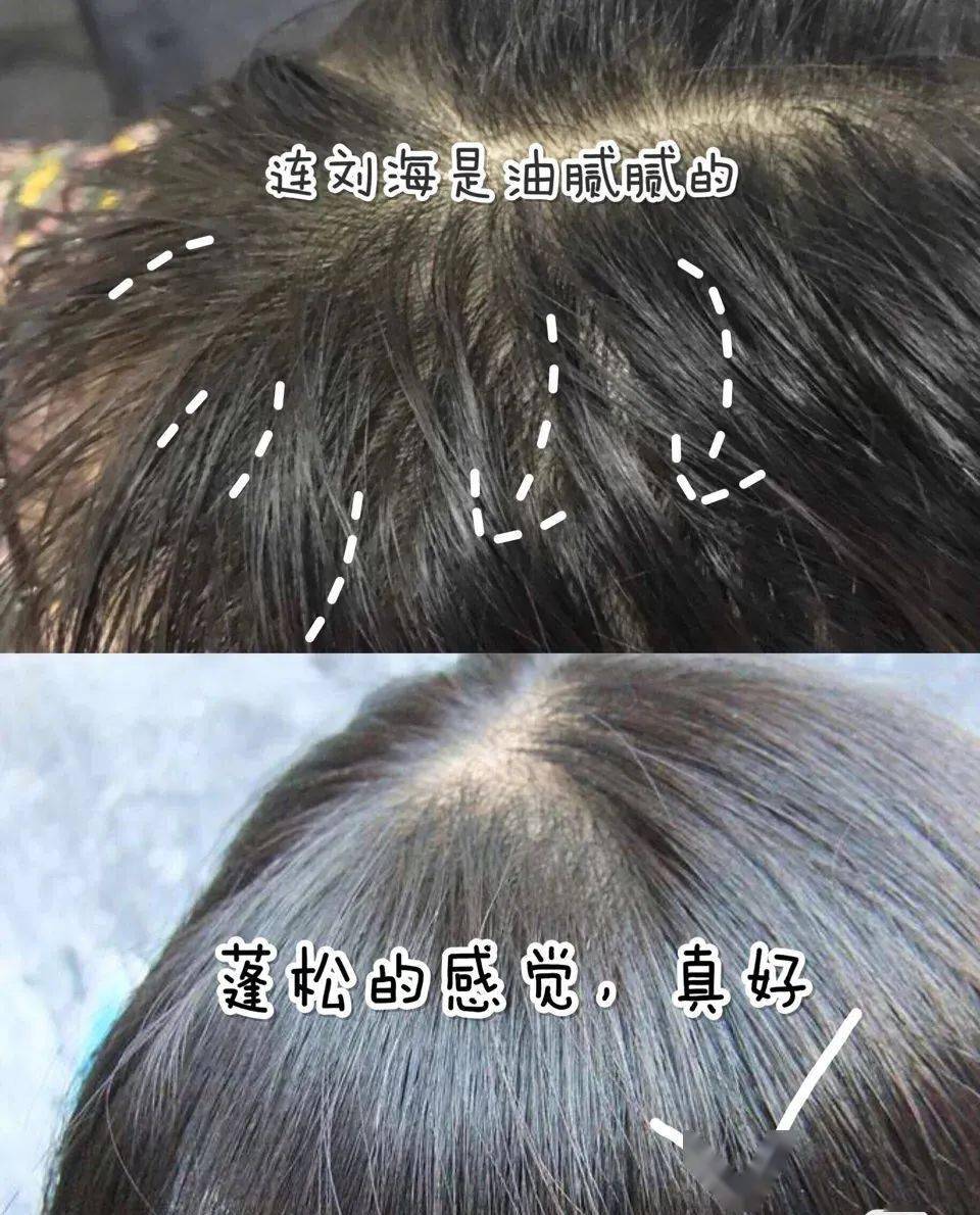 因为散着头发睡觉更健康？99%的女生都做错了，难怪头发油腻还脱发！
