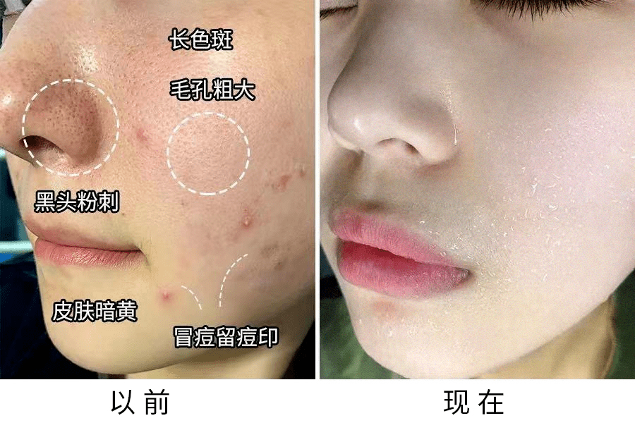 护肤品早晨不要着急洗脸，涂点精华，这样六十岁都肌肤如水！