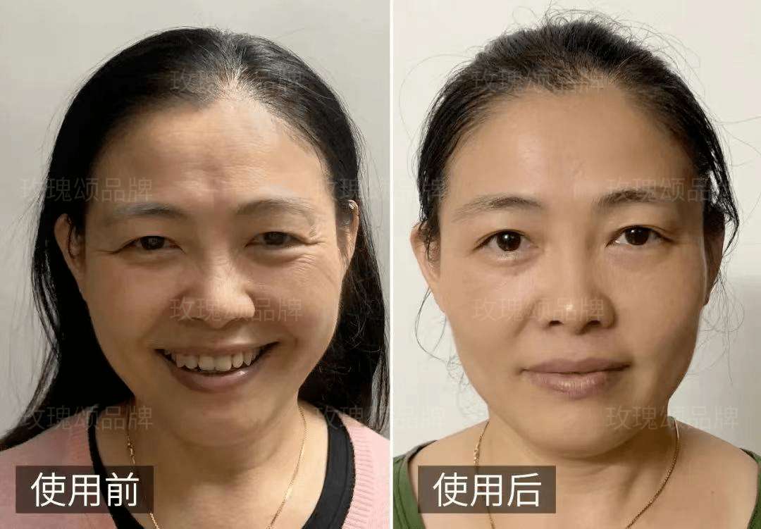 护肤品早晨不要着急洗脸，涂点精华，这样六十岁都肌肤如水！