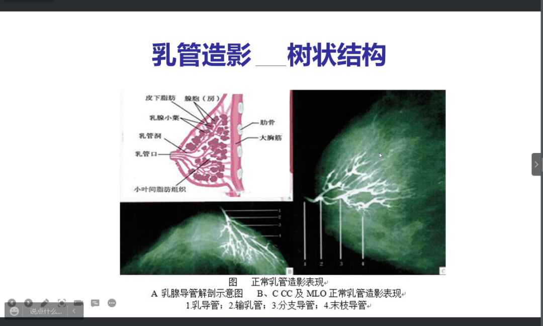 细致讲解《哺乳期乳腺炎诊治》,遇见哺乳期乳腺炎的妈妈,情况严重要
