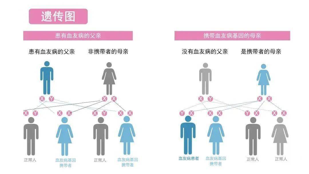 通常来说,女性是血友病基因携带者,她们将基因遗传给下一代,如果生下