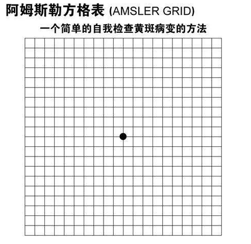 眼底病变自测图图片