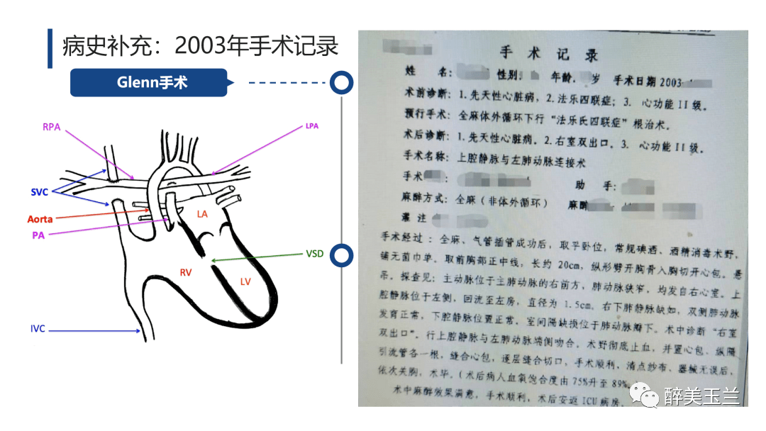 病例讨论妊娠合并复杂先心病剖宫产麻醉管理回看开放