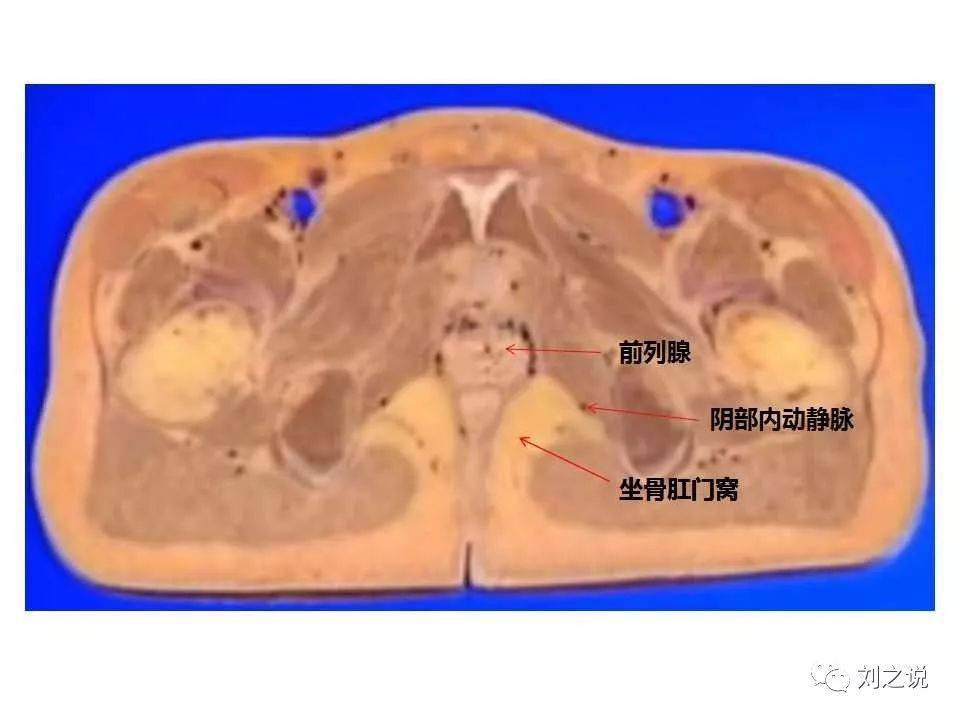 收藏必備男性盆腔斷層解剖