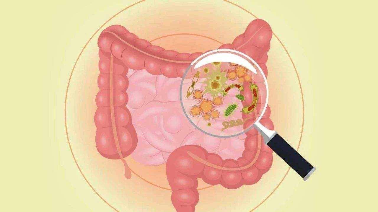 胃肠息肉通过治疗后还会复发是什么原因该如何预防