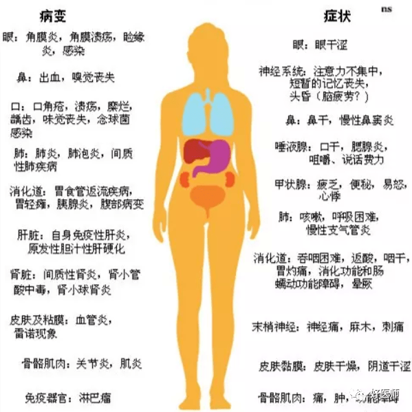 干燥综合征患者合并妊娠的管理