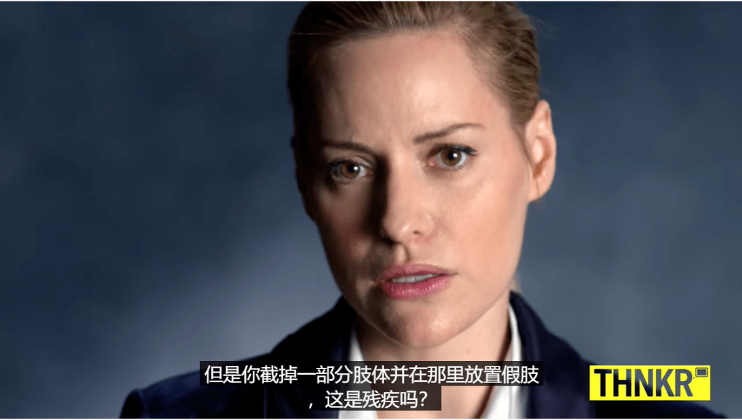 全球身高1米4,却被封“全球最美双腿”,网友:她美哭我了