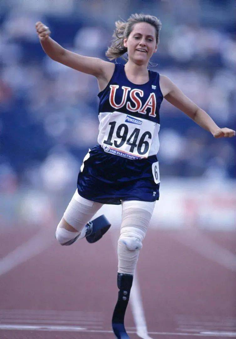 全球身高1米4,却被封“全球最美双腿”,网友:她美哭我了