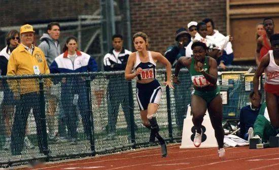 全球身高1米4,却被封“全球最美双腿”,网友:她美哭我了