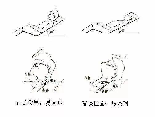 端坐位简易图图片