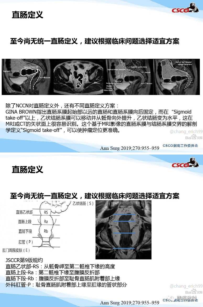 直肠癌mri解剖扫描规范影像学评价结构式报告一文整理