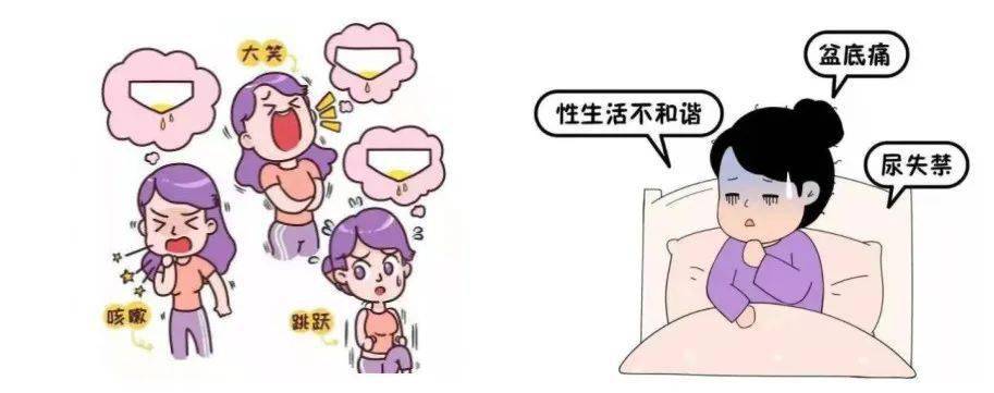 盆底肌受到损伤时就会出现盆底功能的障碍,女性盆底功能障碍性疾病