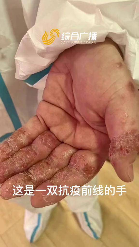 这是一双抗疫前线的手是带给我们安全温暖和力量的手抗击疫情我们一起