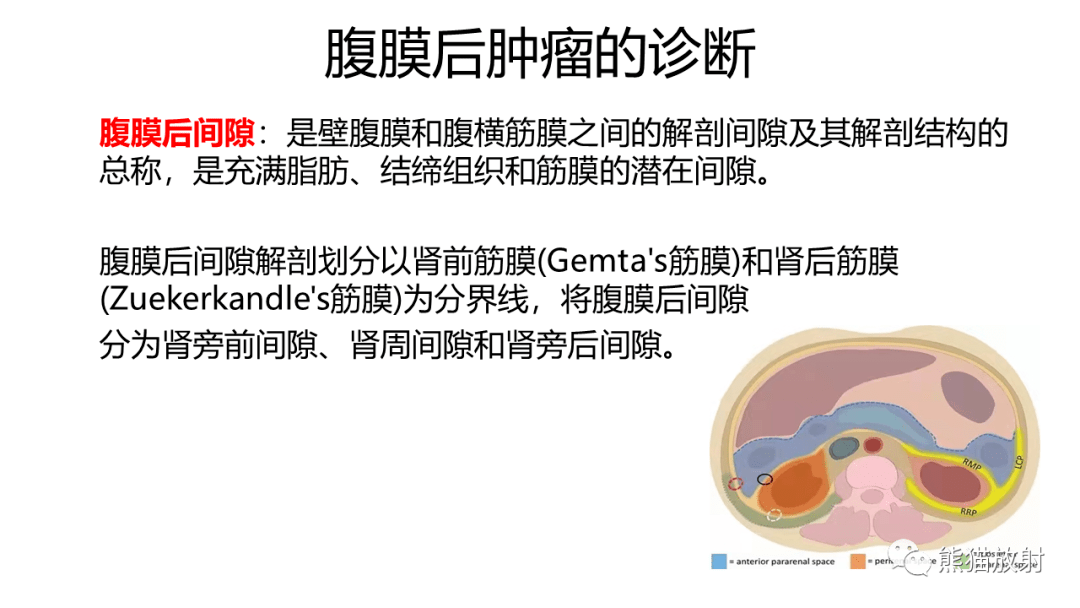 省立影像讀片腹膜後腫瘤2203