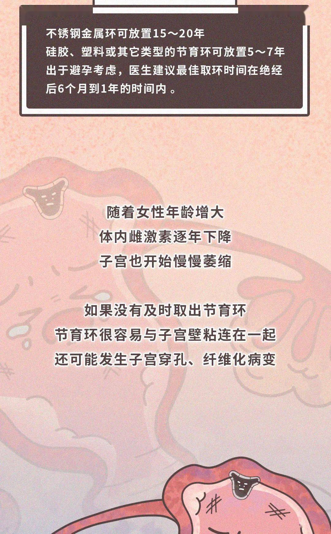 微博|节育环真正的秘密，女性并不知道