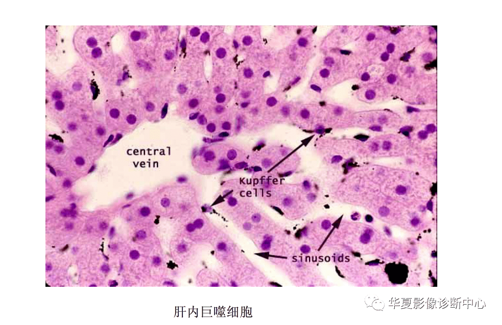 解剖|肝脏影像学与系统解剖