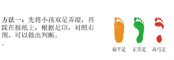 谢主任|扁平足该不该治疗？专家建议必须治、及早治