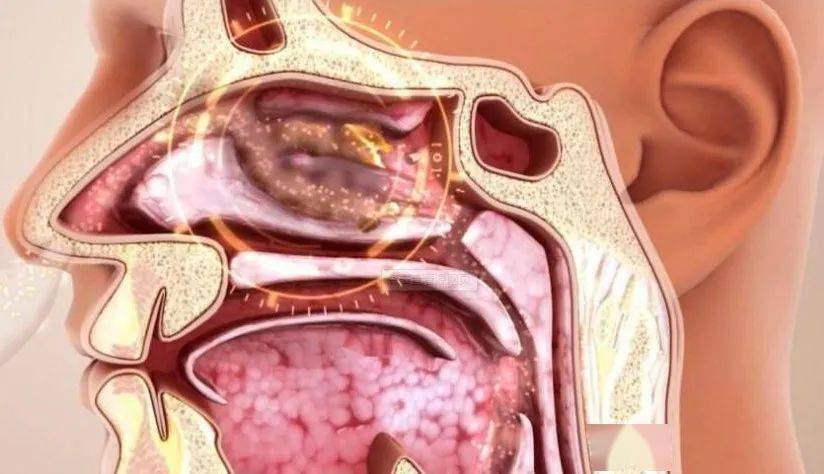 德国鼻炎界神器抑菌率高达995秒通鼻30秒杀菌止痒轻松缓解鼻炎