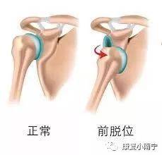 甩手动作不要经常做,不好!
