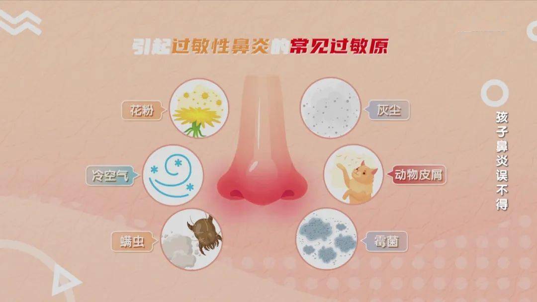 第一步:远离过敏原日常护理这样做孩子过敏性鼻炎过敏性鼻炎会引发