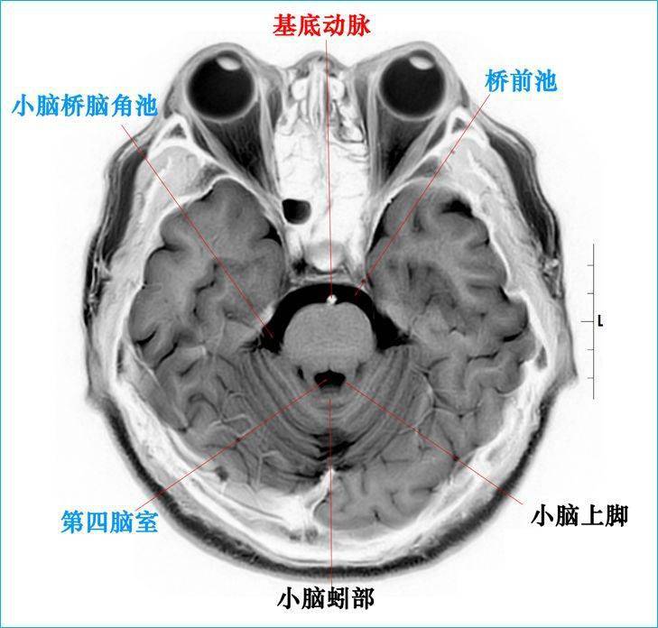 大腦半球標本連續切片斷層解剖·end·全網最全的解剖圖庫,千萬不要