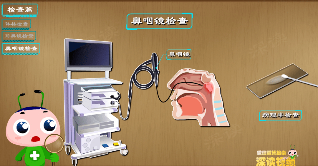 腺样体鼻内镜检查图图片