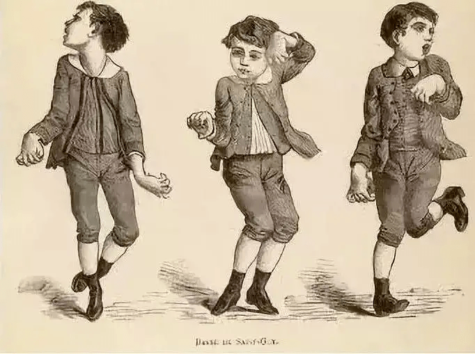 罕见遗传致命舞蹈症你不知道的亨廷顿病