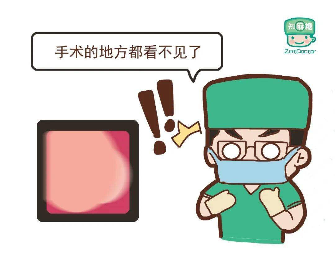 镇痛药留了 15mg 没推50mg 罗库溴铵把本打算推完的35ug 舒芬太尼我