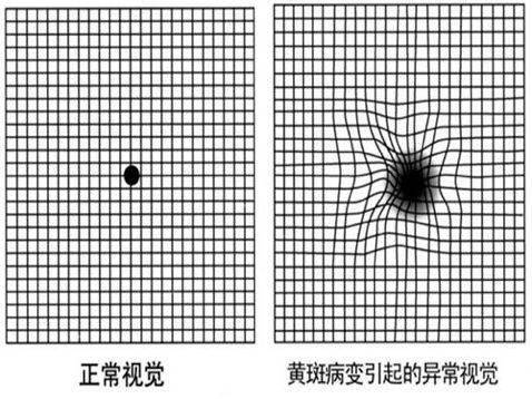 一張圖自測眼健康有圖有真相