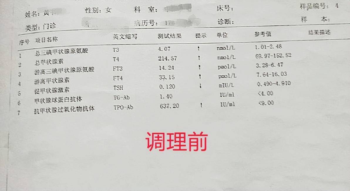 甲亢检查报告单怎么看图片