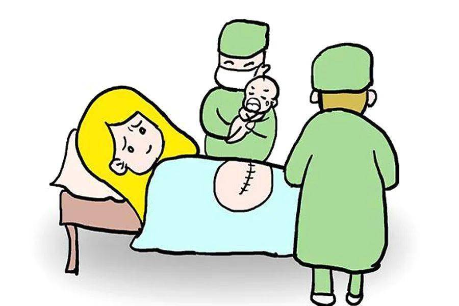 剖宫产手术卡通图片