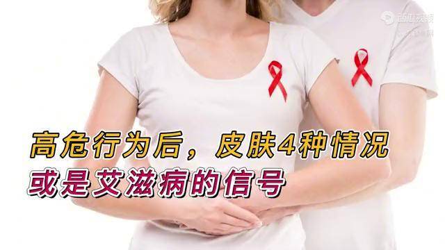 高危行为后,勿把艾滋病当皮肤病!皮肤4种情况,或是身体在求救