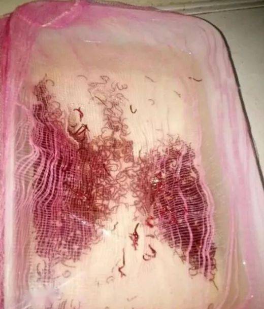 如何轻松分离出活红虫与死红虫