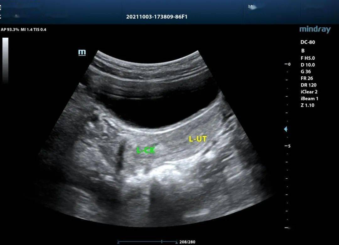 宫颈检查报告单图片图片