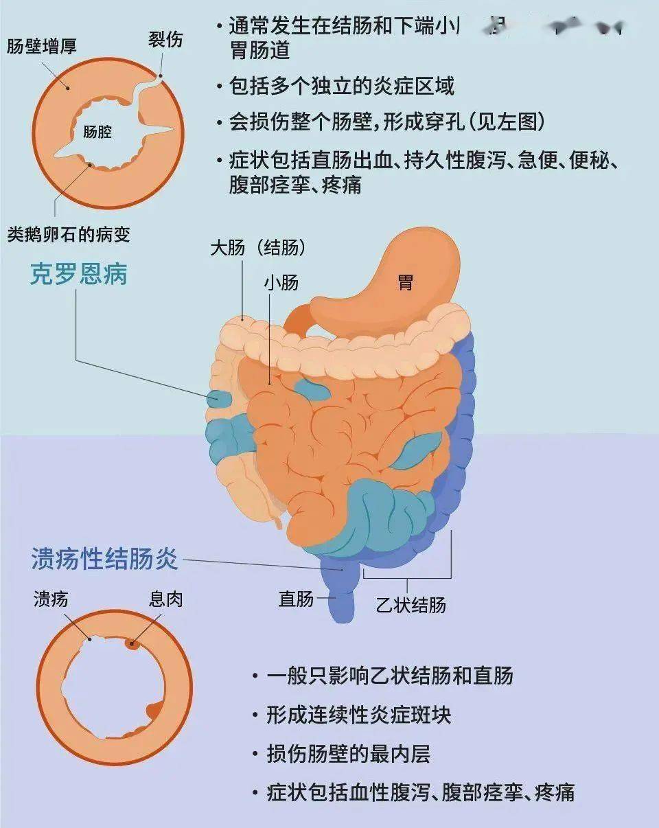 健康科普溃结反复来骚扰新冠疫苗要不要