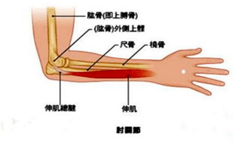 部位就在肘关节这综合起来就是一个慢性的劳损性疾病还有些小碎骨渣有