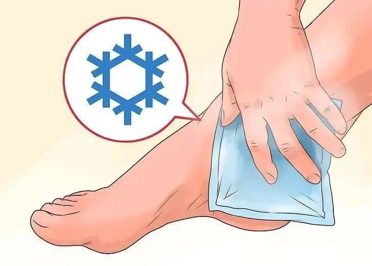 爱运动不是错力挺刘畊宏女孩专家教你扭伤后如何善后