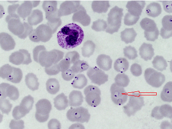 恶性疟原虫雄配子体图片