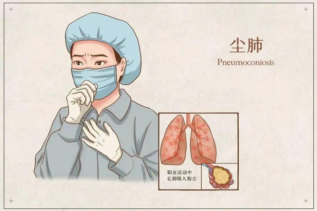 尘肺病卡通图片