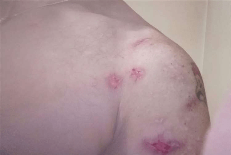 男子搬家误碰蜘蛛洞被咬百次被活活生吃崩溃不敢睡觉