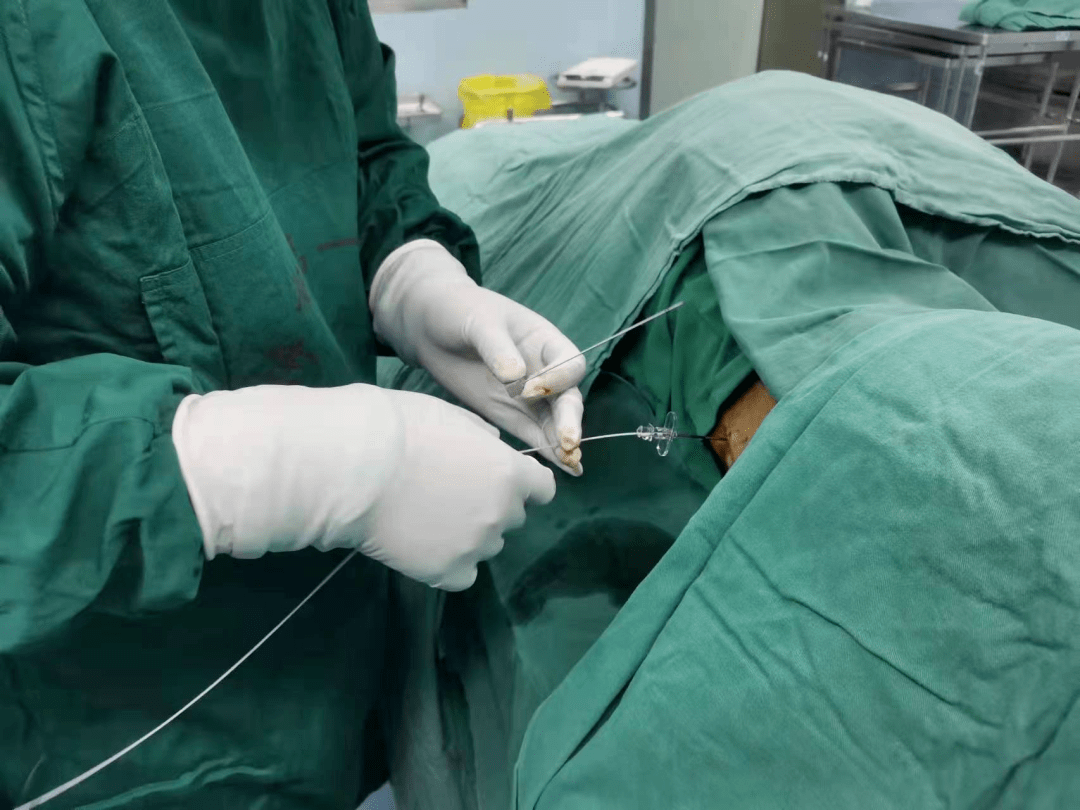 【新技术新业务】鞘内泵镇痛——送给晚期癌痛患者最好的礼物_用药量