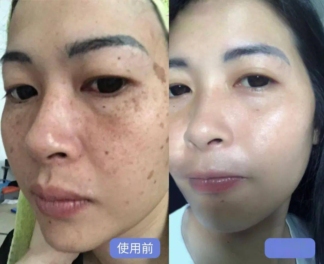 洗面奶中的爱马仕洗一洗斑点黑头毛孔一锅端好用到尖叫