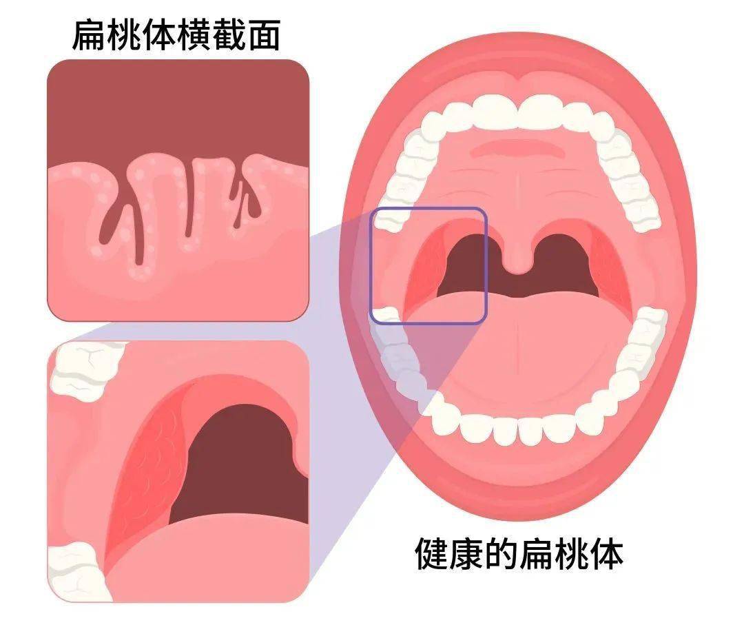 口臭难忍,可能是嘴里藏了垃圾桶