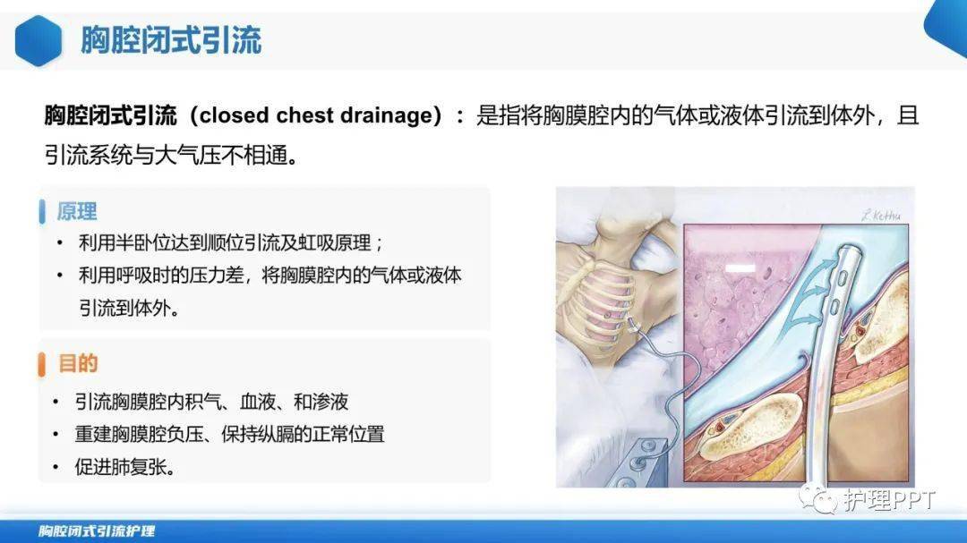 ppt胸腔闭式引流管的护理