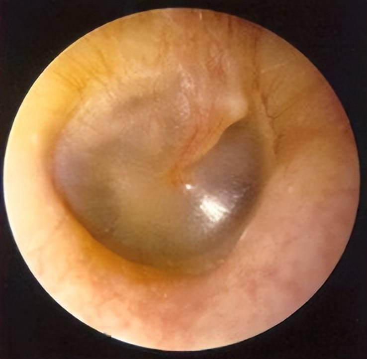耳部解剖—中耳