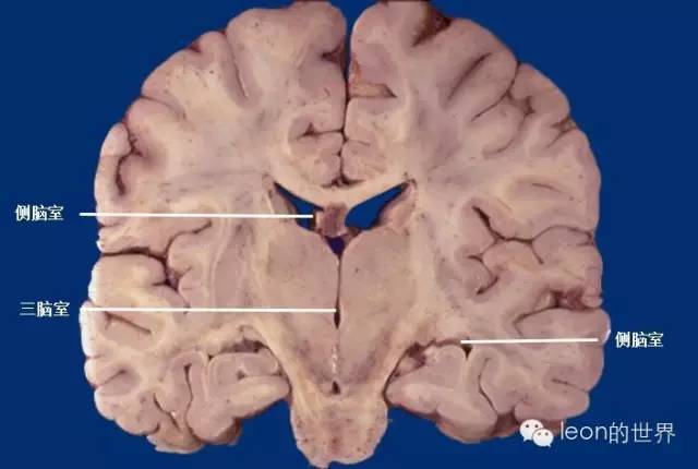 过目不忘的脑室解剖图谱