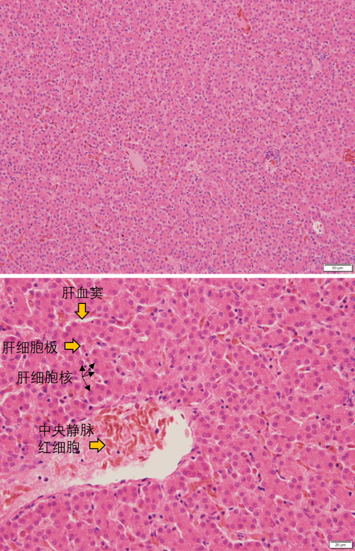 肝脏he染色图片(鸡肝脏,手头没有正常猪肝脏切片)接下来看肝脏的组织