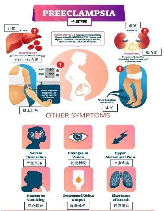 科普世界子痫前期日之孕期重视子痫前期早筛早防